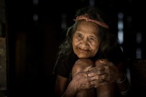 女性の薄毛に効果的なトリートメントは？