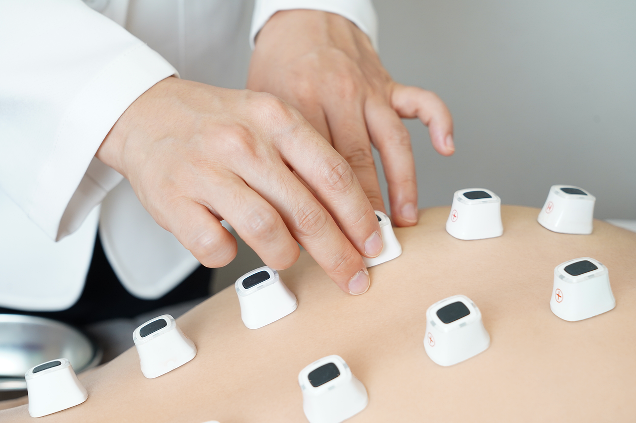 発毛クリニックで併用治療を受けるメリットは？