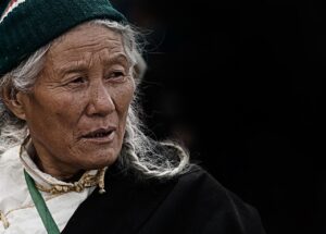 女性の薄毛に悩む方必見！生え際対策はどうすれば良い？